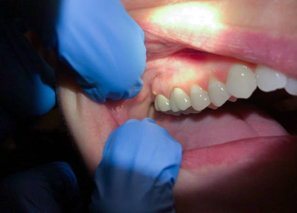 Best Cosmetic Emergency Dentistry in Von Ormy, TX